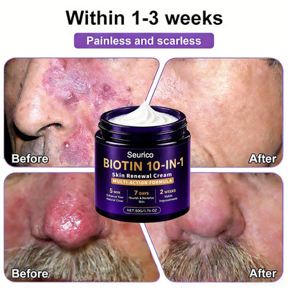 🔥Seurico® Biotin 10-in-1 Skin Restoration Cream