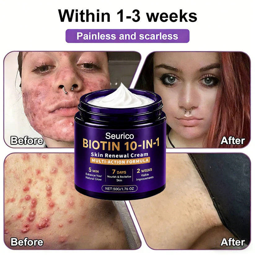 🔥Seurico® Biotin 10-in-1 Skin Restoration Cream