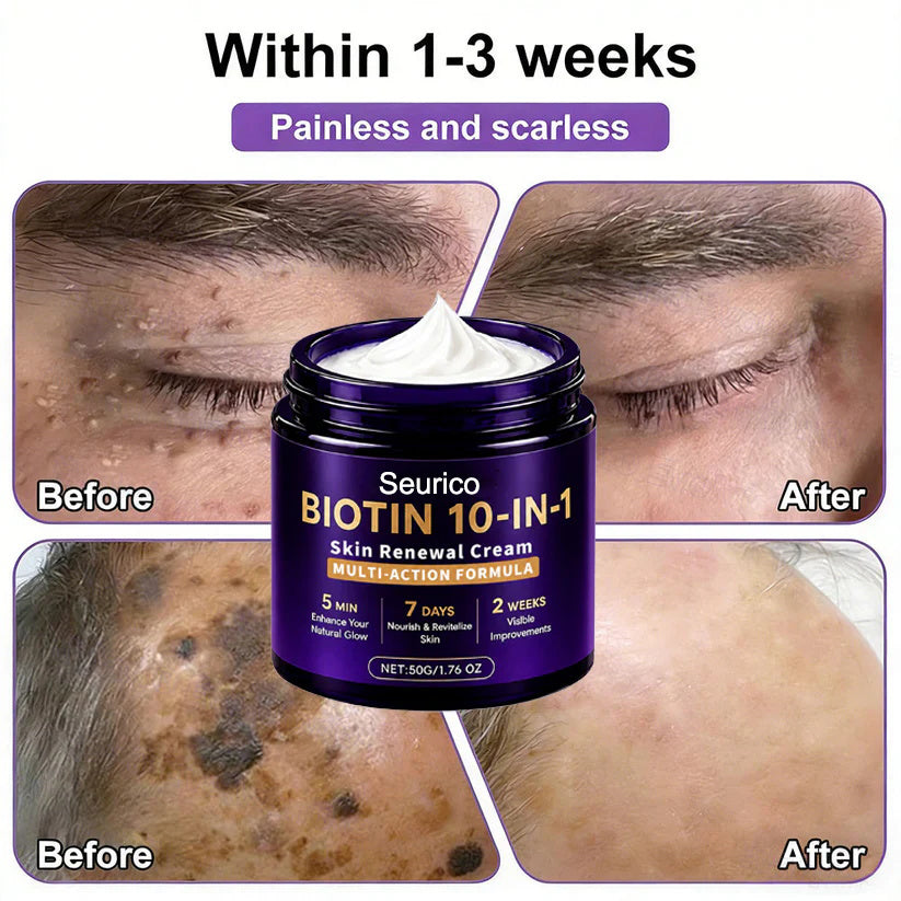 🔥Seurico® Biotin 10-in-1 Skin Restoration Cream