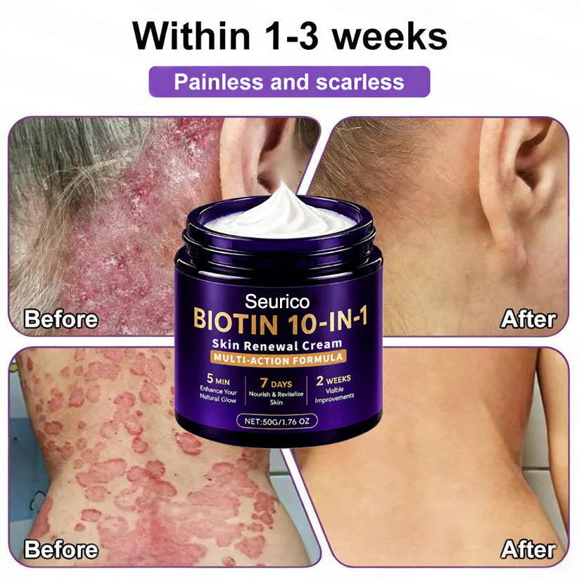 🔥Seurico® Biotin 10-in-1 Skin Restoration Cream