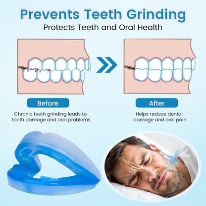 🔥✨[Official Store] JEREMYTIS™ Anti-Snoring & Anti-Grinding Teeth Protector