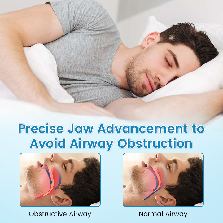 🔥✨[Official Store] JEREMYTIS™ Anti-Snoring & Anti-Grinding Teeth Protector