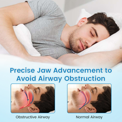 🔥✨[Official Store] JEREMYTIS™ Anti-Snoring & Anti-Grinding Teeth Protector