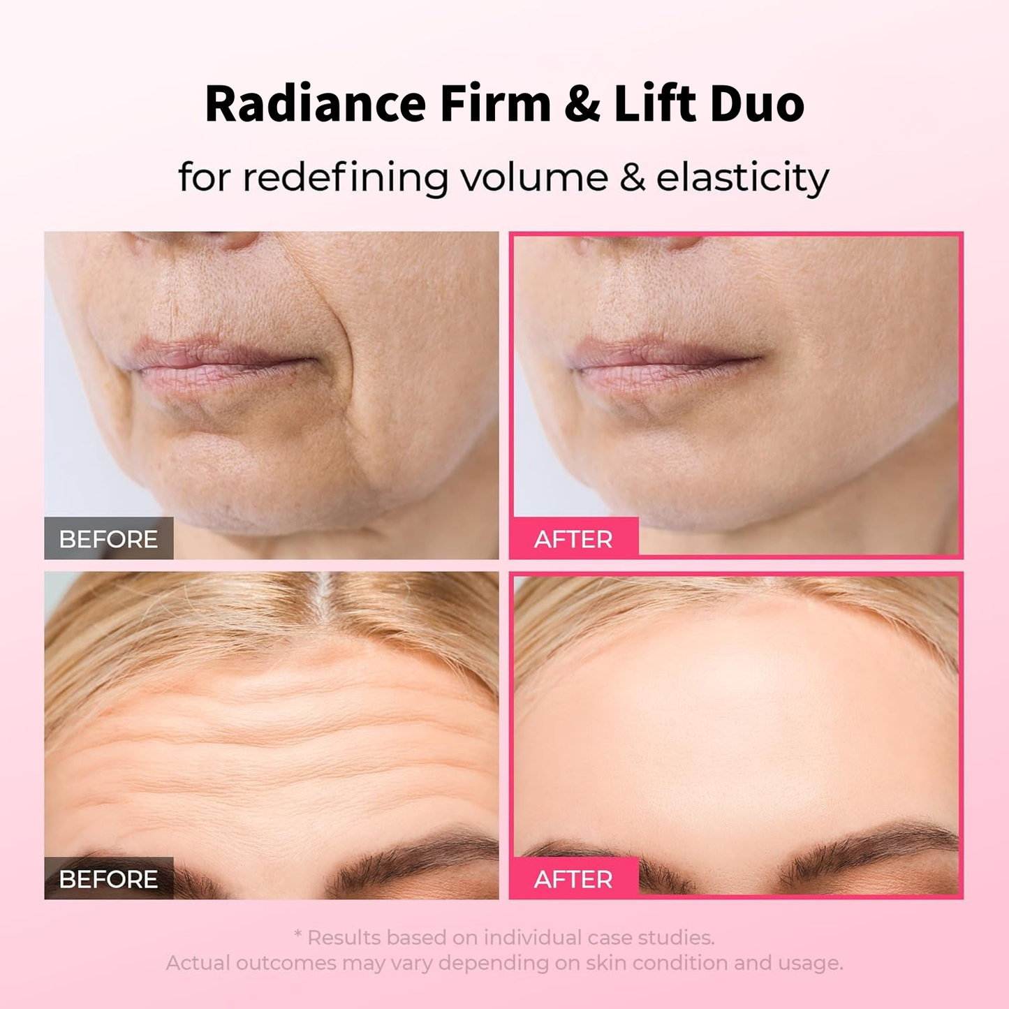 Final 3 Hours: 60%OFF🔥Gifted Collagen Boost 5-Step Set Calcium Collagen Balm for Firming & Pore Care