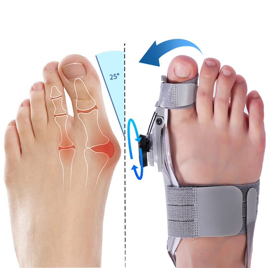 1x Bunion Fix